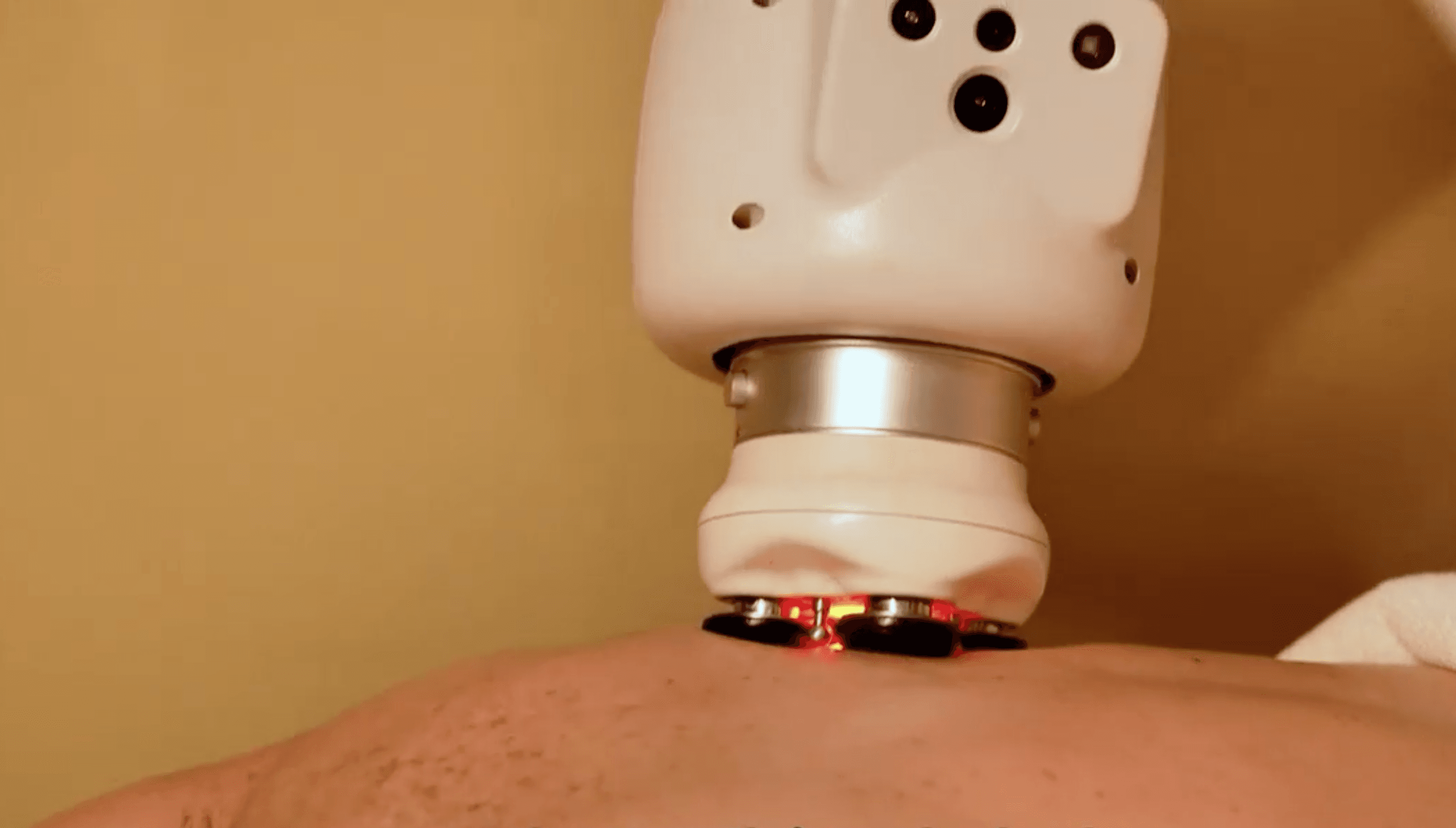AI Smart Heated Bian Stone Massage at AI Health & Wellness Perth